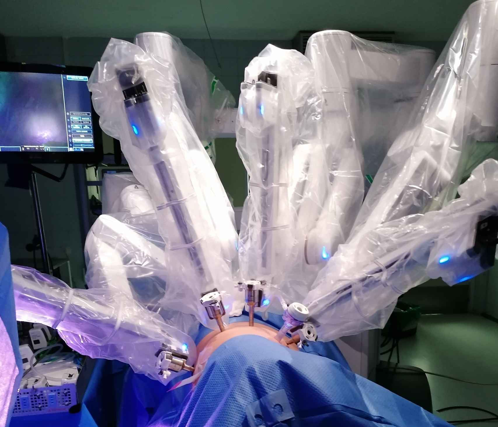 Cirugía robótica en el Hospital de Salamanca