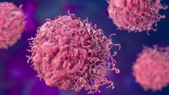 Ilustración 3D de células cancerígenas. iStock