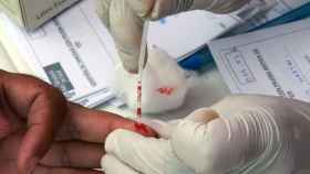 Test de VIH a partir de la gota de sangre de un paciente.