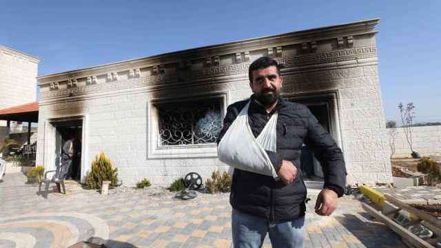 Un palestino herido junto a su casa calcinada por un grupo de colonos israelíes.