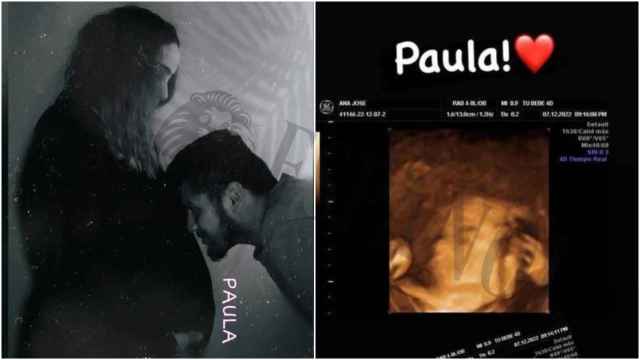 Nacho, besando la tripita de Ana. Al lado, una de las ecografías de Paula, la hija que han perdido tras una cesárea de urgencia en el Hospital Virgen del Castillo de Yecla.