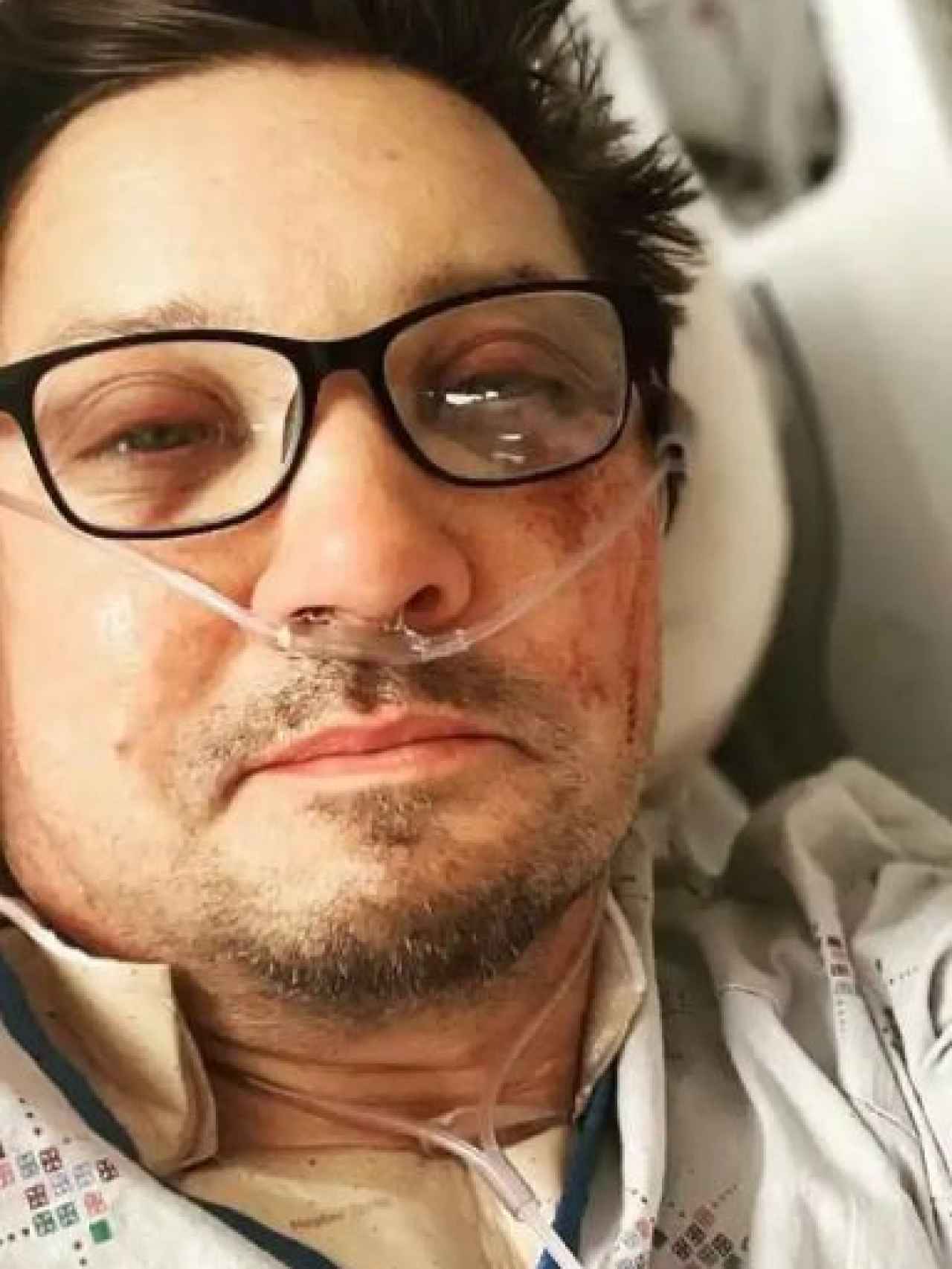 La imagen que el propio Renner compartió en sus redes tras el accidente.