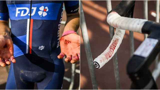 Un corredor del Groupaja FDJ con las manos llenas de heridas tras la Paris-Roubaix