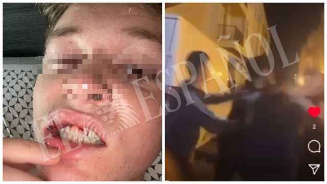 Antonio, el adolescente de 18 años, apaleado por varios menores en Fortuna, en una foto cedida por su padre después de la agresión. Al lado, un fotograma del vídeo de la paliza que se difundió por Instagram.