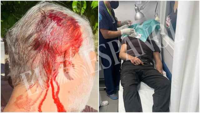 Un policía nacional recibe un hachazo en la cabeza cuando auxiliaba a una mujer en Murcia