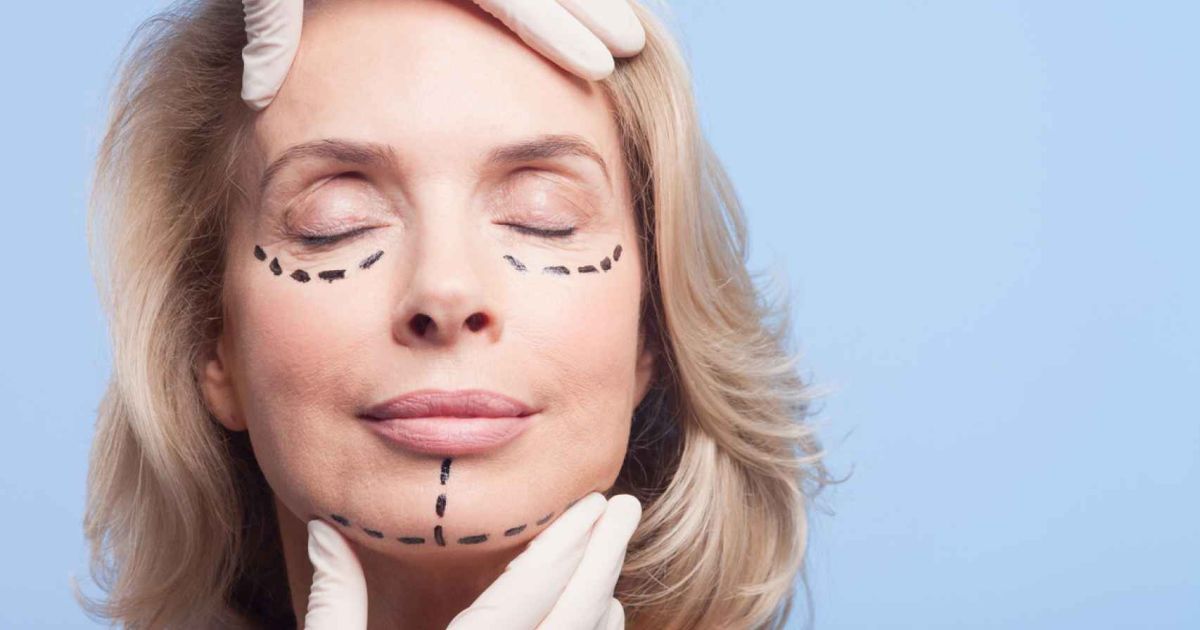 Controversy over facelift surgery: aesthetic or necessity?