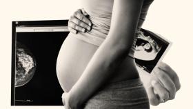 Sólo un 10% de las mujeres logra quedarse embarazada tras el cáncer de mama.
