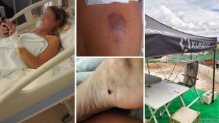 Paqui vuelve a nacer en Cártama (Málaga): un rayo la atravesó de los hombros a los pies el domingo