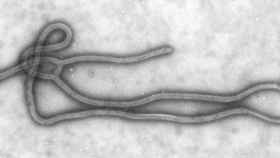Imagen del virus de la enfermedad del Ébola ampliada 108.000 veces.