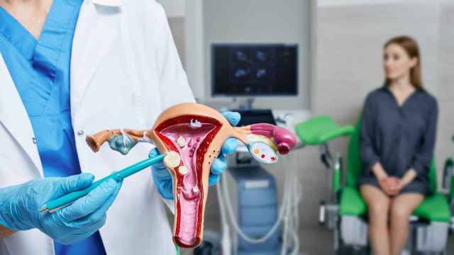 Ginecólogo apuntando leiomiomas uterinos en modelo anatómico de útero durante una consulta ginecológica