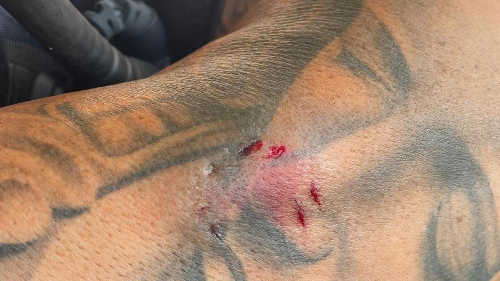 Violencia hembrista: Hiere con un cuchillo a su marido y muerde manos y brazos a poli