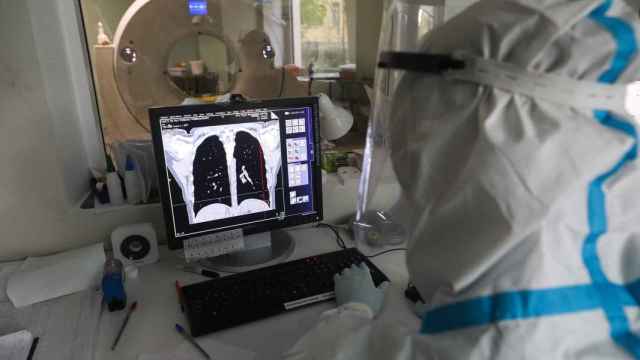 Qué es el cribado de cáncer de pulmón y por qué ningún país en Europa lo implanta aún: las claves