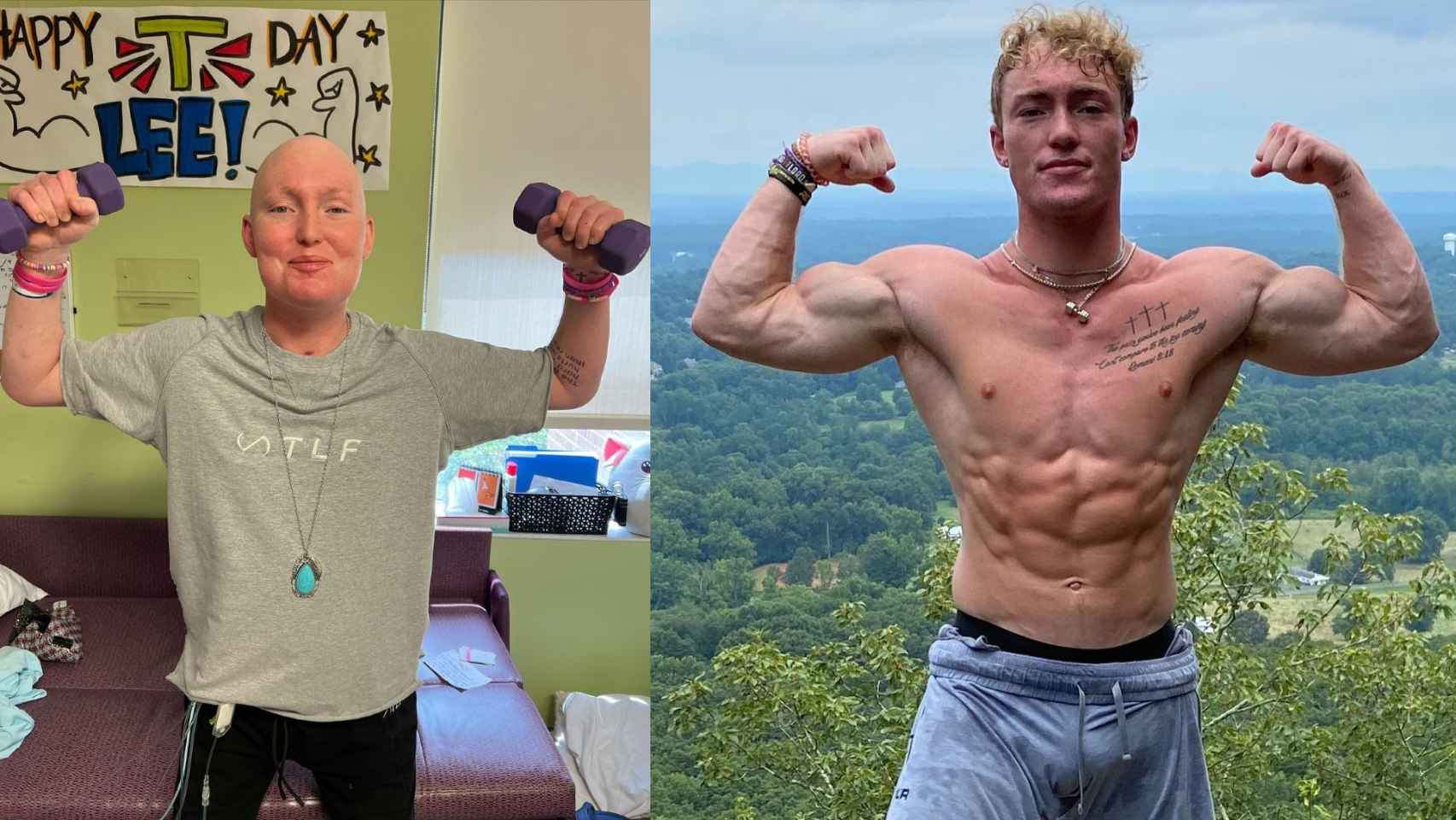 Lee Troutman, antes y después de la enfermedad.