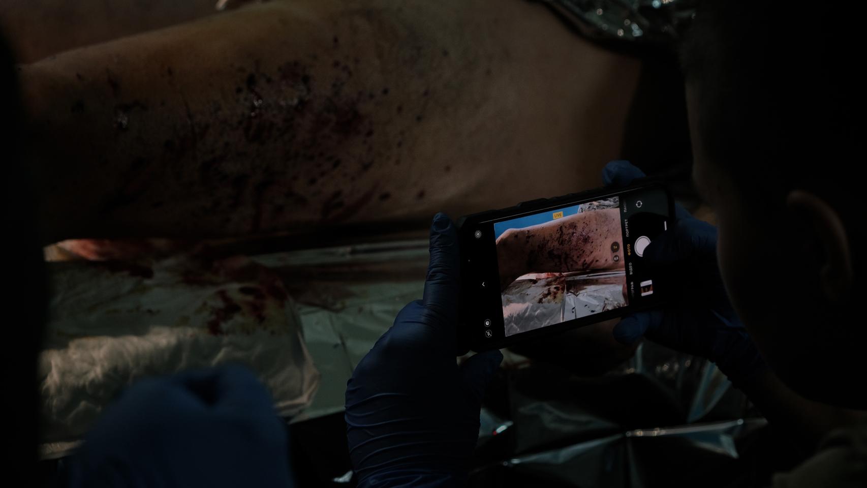 Una médica ucraniana del frente de Bakhmut documenta las heridas de Ruben Mawick a su llegada al punto de estabilización