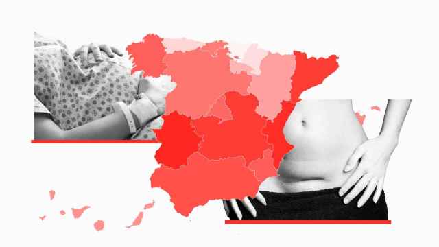 Mapa de los partos por cesárea en España en el año 2021.