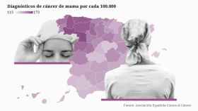 Diagnósticos de cáncer de mama en España por cada 100.000 habitantes.